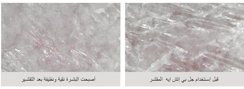Ar PHA peeling gel3 e1631271154293 Kbeauty for Arabs