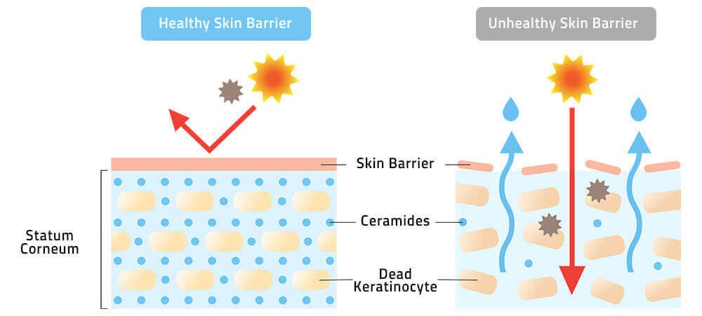 What you need to know about the skin barrier 04 Kbeauty for Arabs