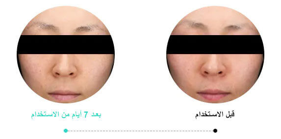 pore remedy 10 1 Kbeauty for Arabs