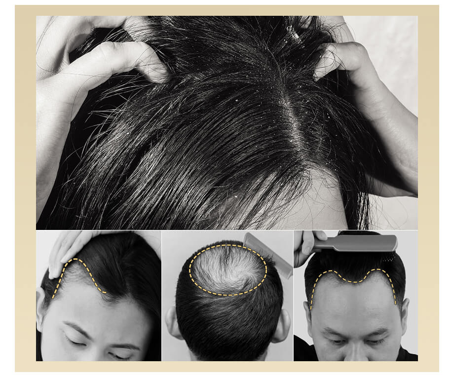 scalp care device
